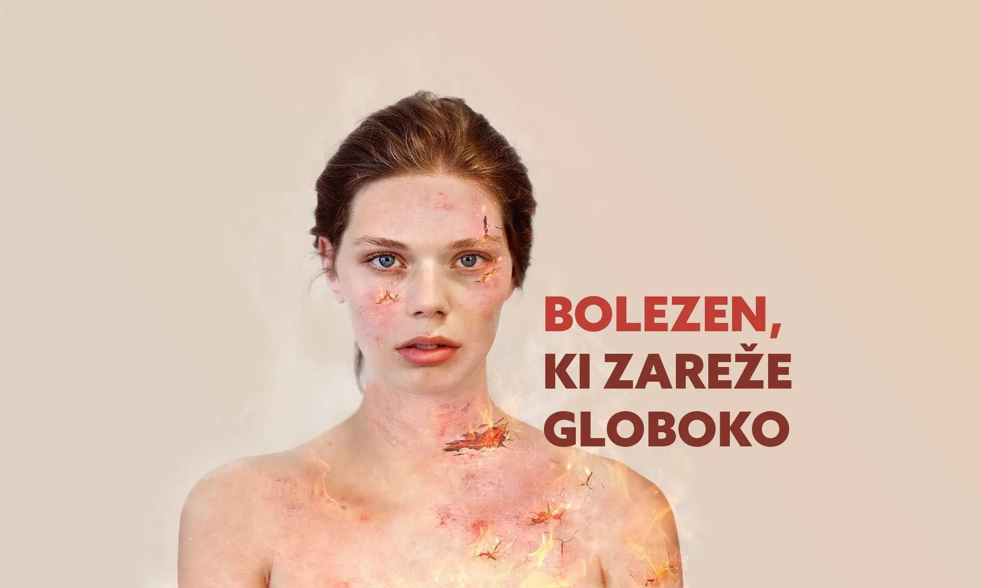 Zavod Atopika - Celostna kampanja